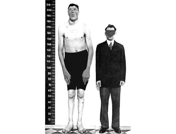 چگونه یک آدم قد کوتاه به یکی از بلند قامت ترین انسان های روی زمین تبدیل شد؟ ، ماجرای باور نکردنی مردی که به یکباره قدش دراز شد